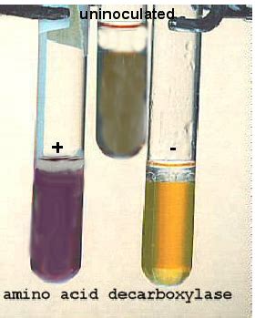 lysine decarboxylase test|decarboxylation test quizlet.